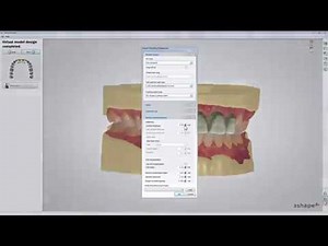 Pshysical Wax up Design