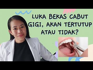 Gusi luka bekas cabut gigi apakah akan tertutup atau tidak?