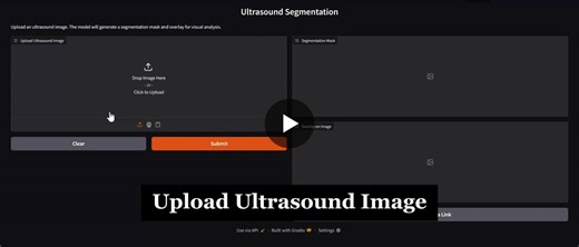 AI-Powered Breast Ultrasound Segmentation with U-Net and ResNet50V2 | Daniel Akinbankole posted on the topic | LinkedIn