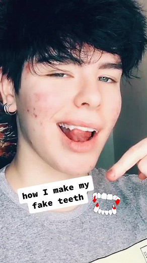 DIY Fake Teeth Tutorial: Create Your Own Customized Teeth at Home!