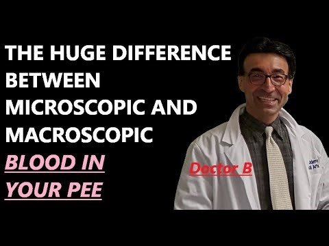 THE HUGE DIFFERENCE BETWEEN MACROSCOPIC AND MICROSCOPIC BLOOD IN YOUR PEE.