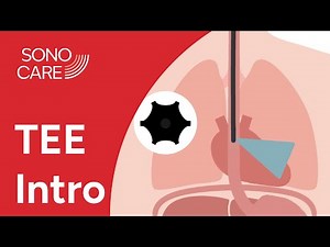 Resuscitative TEE: Introduction