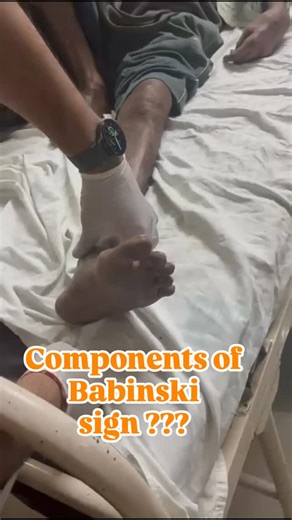 Dr Dhirender Chaudhary | Treat and Travel on Instagram: "what are the components of positive babinski sign ? 1. Extension (dorsiflexion) of great toe – the primary component 2. Extension of small toes 3. Fanning (abduction) of all toes 4. Flexion at ankle joint 5. Flexion at knee joint 6. Flexion at hip joint 7. Contraction of tensor fascia lata Denote - UMN lesion 😎😎😎 Root value - S1 #medical #med #doctor #mbbs #medicine #neurology #medicine"