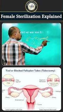 महिला नसबंदी कैसे होती है II Female Sterilization Explained