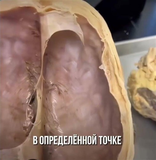 Верхняя часть настоящего человеческого черепа.