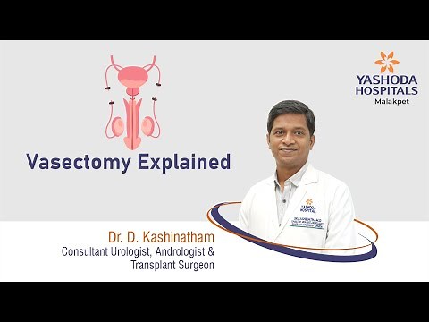 Vasectomy Explained | Yashoda Hospitals Hyderabad