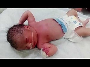 Cute Little Baby Passed IV Line Procedure | Baby IV Cannulation 💕😆 #BabyCare #NICU