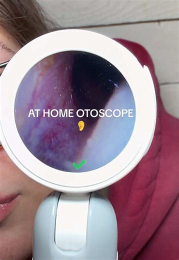 ear pain relief at home | ear infection check at home | digital otoscope with screen | ear camera for kids and adults | home ear scope tool | check ear infection without doctor visit | ear wax removal camera | HD ear camera with display | at home ear exam tool | smart otoscope with camera | parent must have health tool | toddler ear check device | see inside ear at home | avoid urgent care visit tool