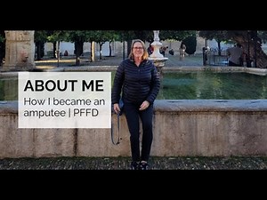 About Me | How I became an amputee
