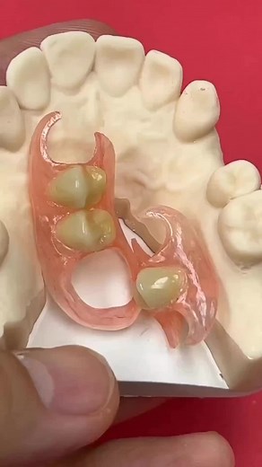 Prótesis Removible Acker Flexible para Higiene Dental