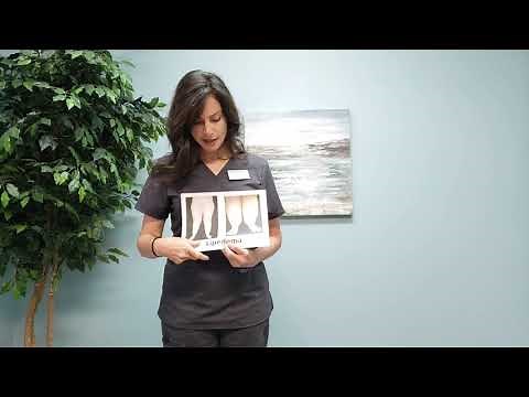 Lymphedema vs Lipedema: How to know the difference