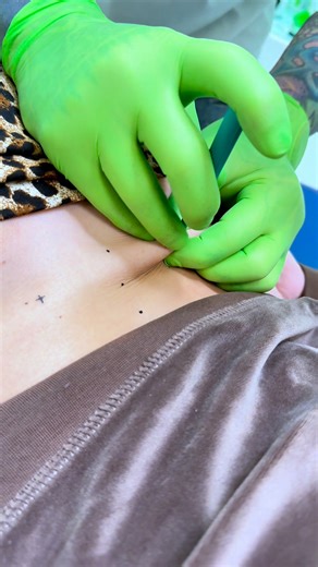 DIMPLE MICRODERMAL ✨ #MicrodermalPiercing #DermalPiercing #PiercingBodyModification #PiercingAddict #BodyPiercingArt #PiercingLifestyle #SkinImplant #MicrodermalTattoo #PiercingInspiration #PiercingDesign #PiercingCommunity #TattooAndPiercing #Unique | Piercing.pigs