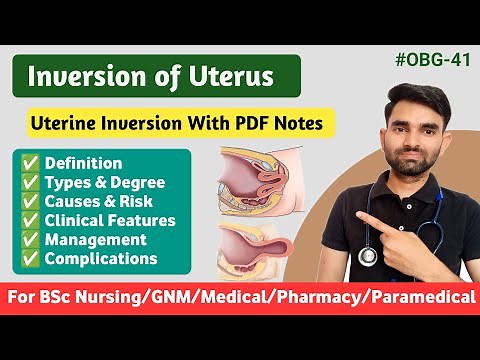 Inversion of Uterus in Hindi | Types, Causes, Symptoms And Management of Uterine Inversion