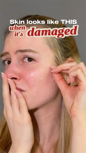 Ana Maria Staniloiu on Instagram: "This is your reminder to stop fighting your skin and start nourishing it🤍 Dry patches, irritation and dullness can be signs of a stresed, damaged skin barrier. The fix? No, it absolutely isn’t scrubbing or layering more actives to overwhelm your skin even more. (…trust me, I learned the hard way😬) Instead, make barrier strengthening your main goal and maintain proper skin moisture to support it💪🏻 💾 Save this for next time you’re dealing with flaky skin! 🤍