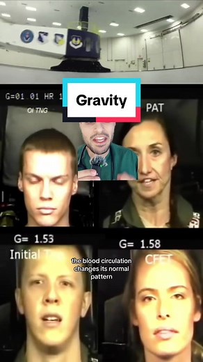 #medicine #medical #gforce #bloodcirculation #circulation #fainting