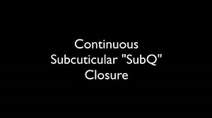 Continuous SubQ (subcuticular) suture