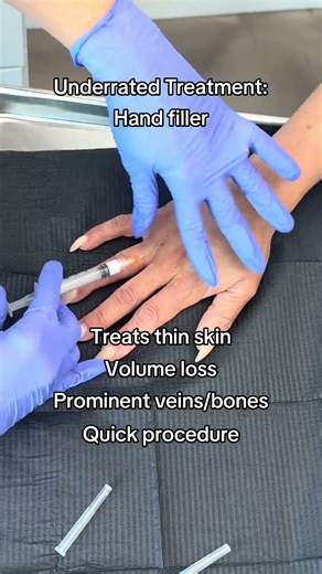 Hand filler
