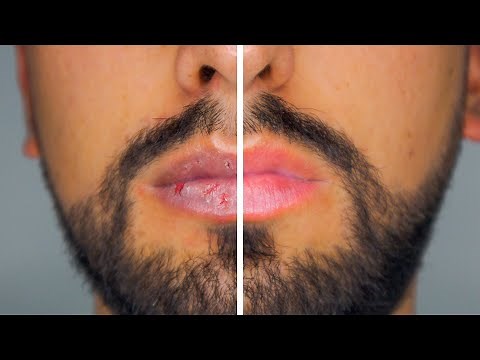 El Mejor Truco Para Hidratar Los Labios Resecos Y Agrietados