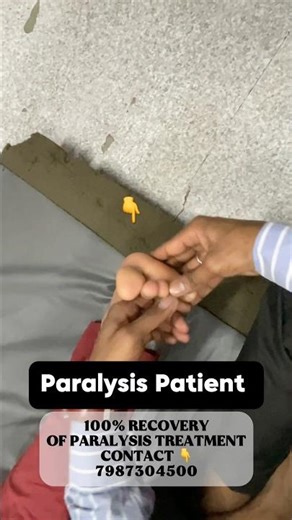 Paralysis Exercises 💪