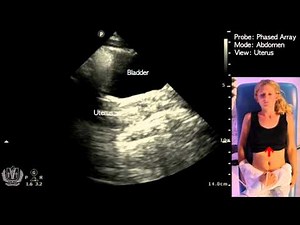Basic Evaluation of Pelvic Anatomy (Female) using Ultrasound