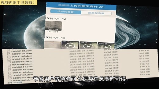dcm文件查看器？dcm文件用什么打开？怎么看ct影像图？