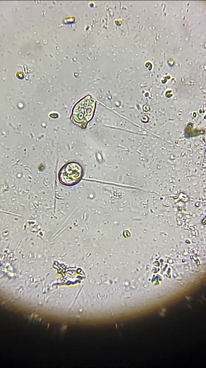 4.3K views · 32 reactions | Protozoa in a bucket of rainwater #protozoa #microbes #microorganisms #rainwater #parasites #soil | Learn To Grow | Facebook