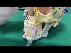Middle Superior Alveolar nerve block
