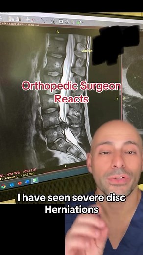 Deadlifts and Spine Health: What You Need to Know