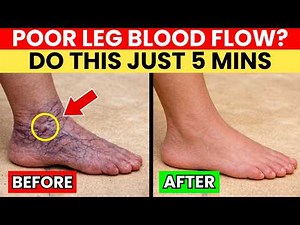 Poor Leg Circulation? 3 Easy & FAST Exercises + 30-Second Test