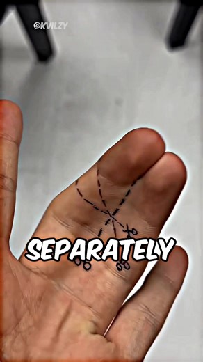 His Fused Fingers Made Him Famous!#viralvideo #unique #fingers | wiggly finger guy