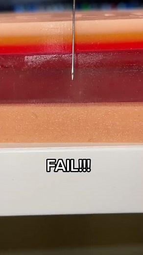 Why Do Needles Hurt So Much? Understand the Painful Process