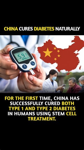 globebuzzdaily on Instagram: "Scientists in China may be on the verge of curing diabetes! 🇨🇳✨ In two groundbreaking cases, researchers successfully reversed both Type 1 and Type 2 diabetes using personalized stem cell therapy. In Beijing, a 25-year-old woman with chronic Type 1 diabetes became insulin-free just 75 days after receiving new insulin-producing cells made from her own fat. Meanwhile, in Shanghai, a 59-year-old man with Type 2 diabetes was cured using islet cells derived from his ow