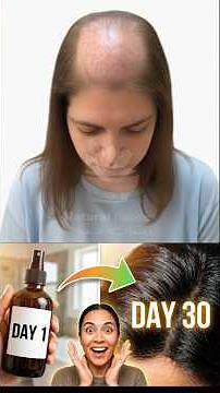 Stop Hair Loss FAST 🌿 | Rosemary & Clove Water Challenge (30 Days Results!) #naturalhaircare