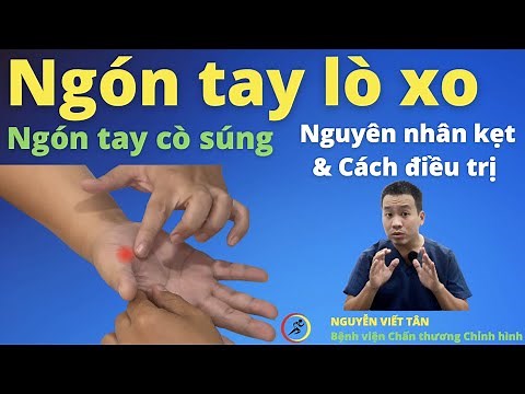 Ngón tay lò xo (ngón tay cò súng) nguyên nhân kẹt và cách điều trị | Khớp Việt Official