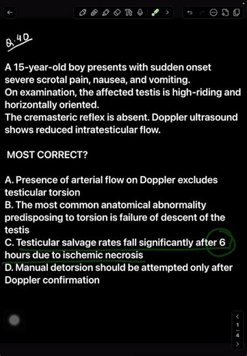 Testicular Torsion MCQ l Time Is Testis