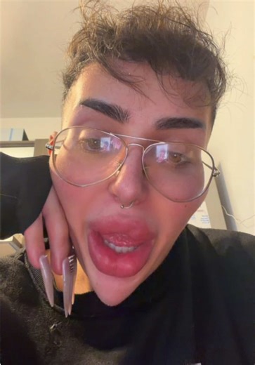 Ξέρω ότι βγαίνω σαν τη τρελή με τα γυαλιά και το μαλλί της Κρουέλας 😅 αλλά δεν άντεχα, ήθελα να το πω. Τον τελευταίο καιρό έχω ακούσει διάφορα κάτω από τα βίντεό μου και συνειδητοποίησα κάτι πολύ απλό. Δεν θέλω πια να κρύβω κανένα κομμάτι μου. Ούτε το παρελθόν μου, ούτε την εξέλιξή μου, ούτε πράγματα που έχουν συμβεί στη ζωή μου. Κάποια από αυτά ίσως τα μοιραστώ όταν νιώσω πιο έτοιμ@, γιατί υπάρχουν εμπειρίες που σε αλλάζουν και σε κάνουν να βλέπεις τα πράγματα αλλιώς. Αυτό που έμαθα όμως είναι