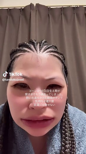 コーンロウのかゆみ対処法