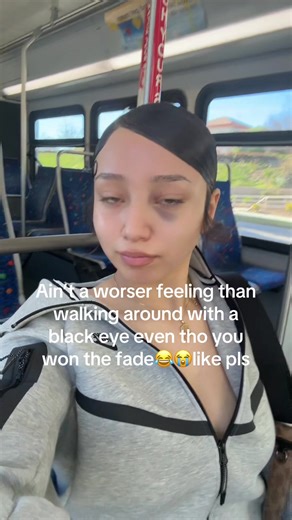 Like society I promise I didn’t get beat up hoes js use rings and love to jump😢