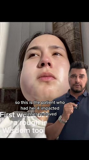 Wisdom Teeth Removal Recovery: What to Expect