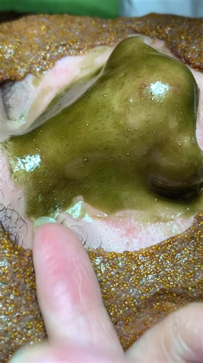 Hướng dẫn chăm sóc da miễn phí tại Lqspa&Academy