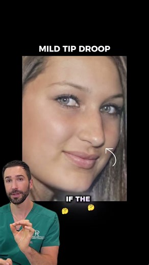 A non-surgical nose job? #doctor #nose #nonsurgical #face