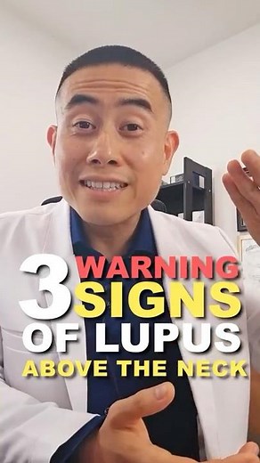 3 Early Signs of Lupus That Appear Above the Neck