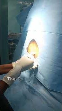 💉 One injection. Complete pain relief below the waist. Here's how Spinal Anaesthesia works! 🩺