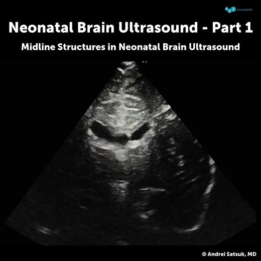 Neonatal Brain US: Part 1