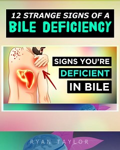 323K views · 1.8K reactions | 12 Strange Signs of a BILE Deficiency #bile #biledeficeincy #cholestasis #bileducts #liver #liverhealth #gallbladder #gallstones #naturalremedies #ryantaylornaturalremedies | Ryan Taylor Natural Remedies | Facebook