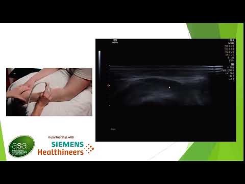 Ultrasound of the RCL and LUCL