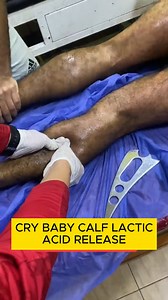 1.7M views · 3.7K reactions | Calf lactic acid release  | Massagelih | Facebook