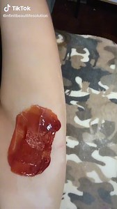 ON PROCESS UNDERARM WAXING LOVE LOVE THE RESULT YON BANG PAG TUBO NG HAIR MANIPIS PLUS EFFECT NA KIKINIS AT PUPUTI ANG UNDERARM YES NA YES LETERAL WHATSAPP 0172856388 BOOK FOR YOUR APPOINTMENT NOW | Infinity Beauty Life Solutions | Facebook