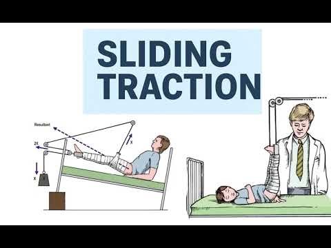 Sliding Tractions MASTERED: Buck's, Bryant's, Perkins & More!|Ortho Practical | DNB MS Ortho |