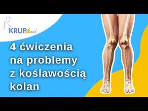 4 ćwiczenia na problemy z koślawością kolan